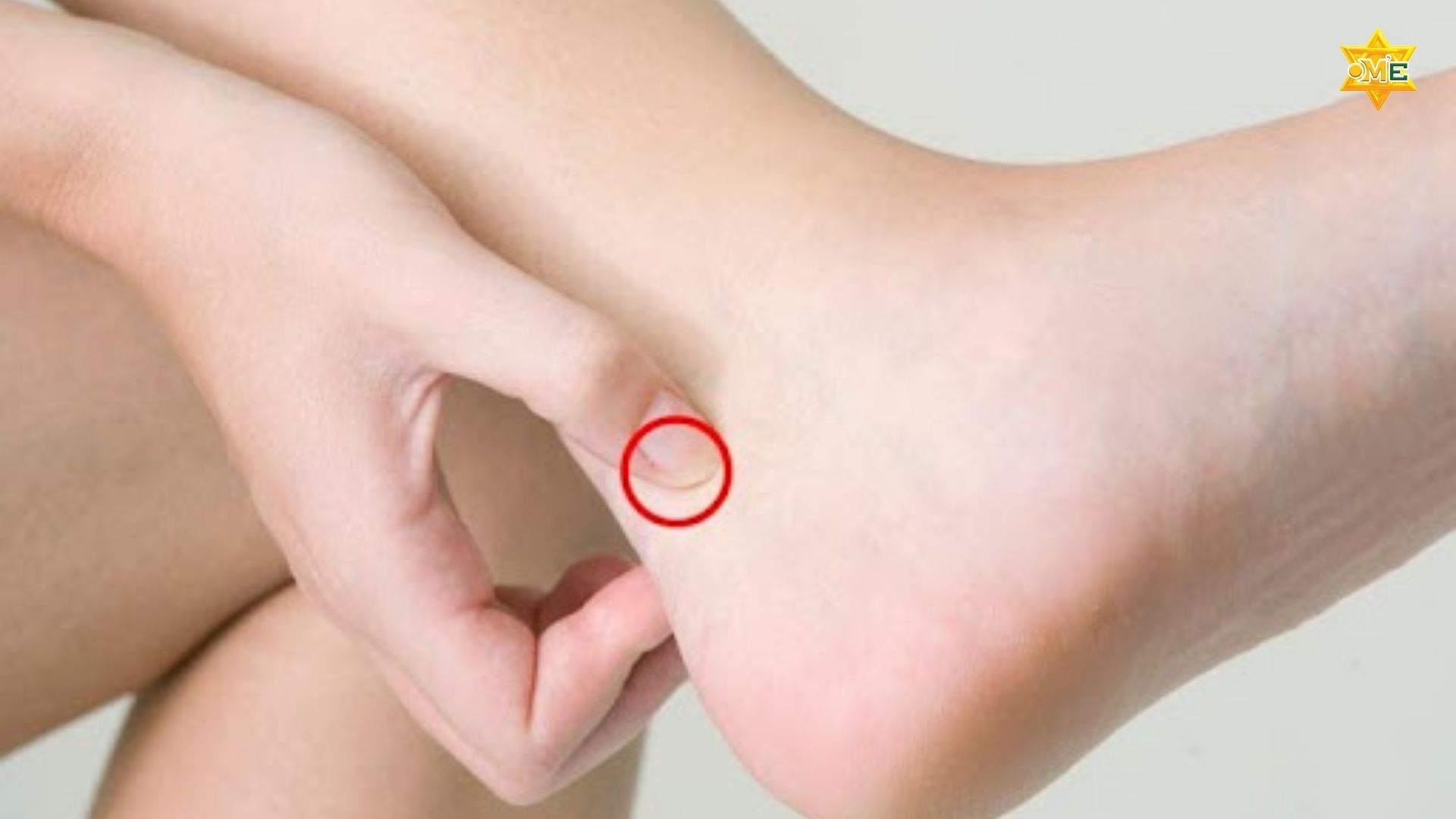 Cách xác định huyệt Thái Khê chuẩn xác