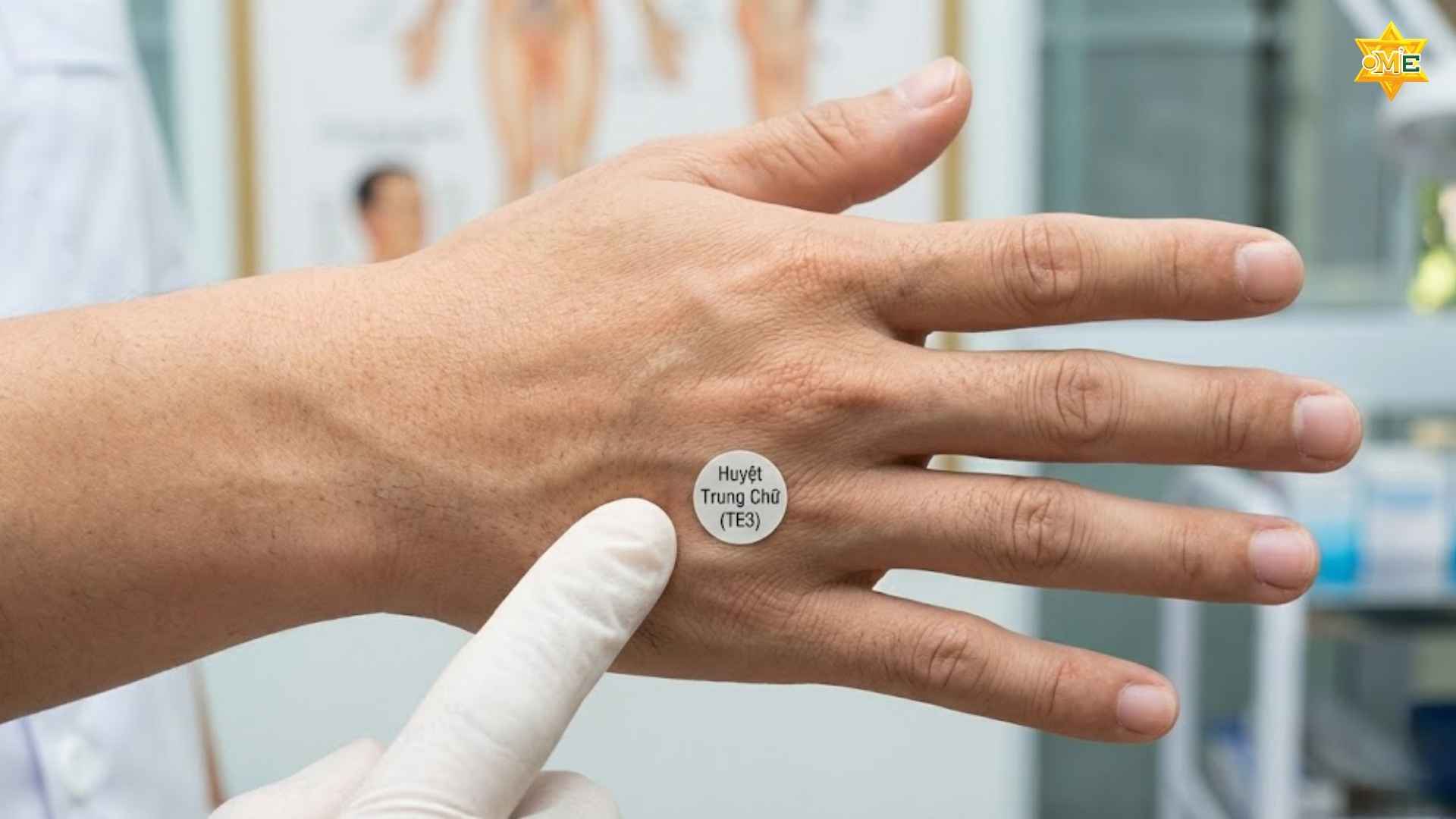 Cách xác định huyệt trung chữ chuẩn xác