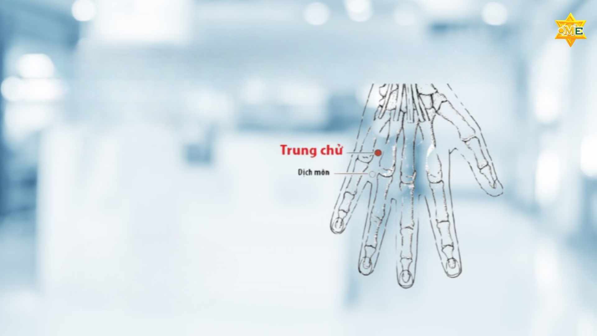 Cách xác định huyệt trung chữ chuẩn xác