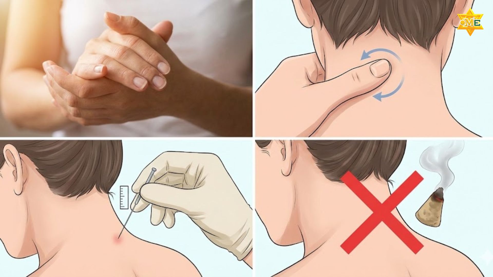 Cách xác định huyệt á môn chuẩn xác