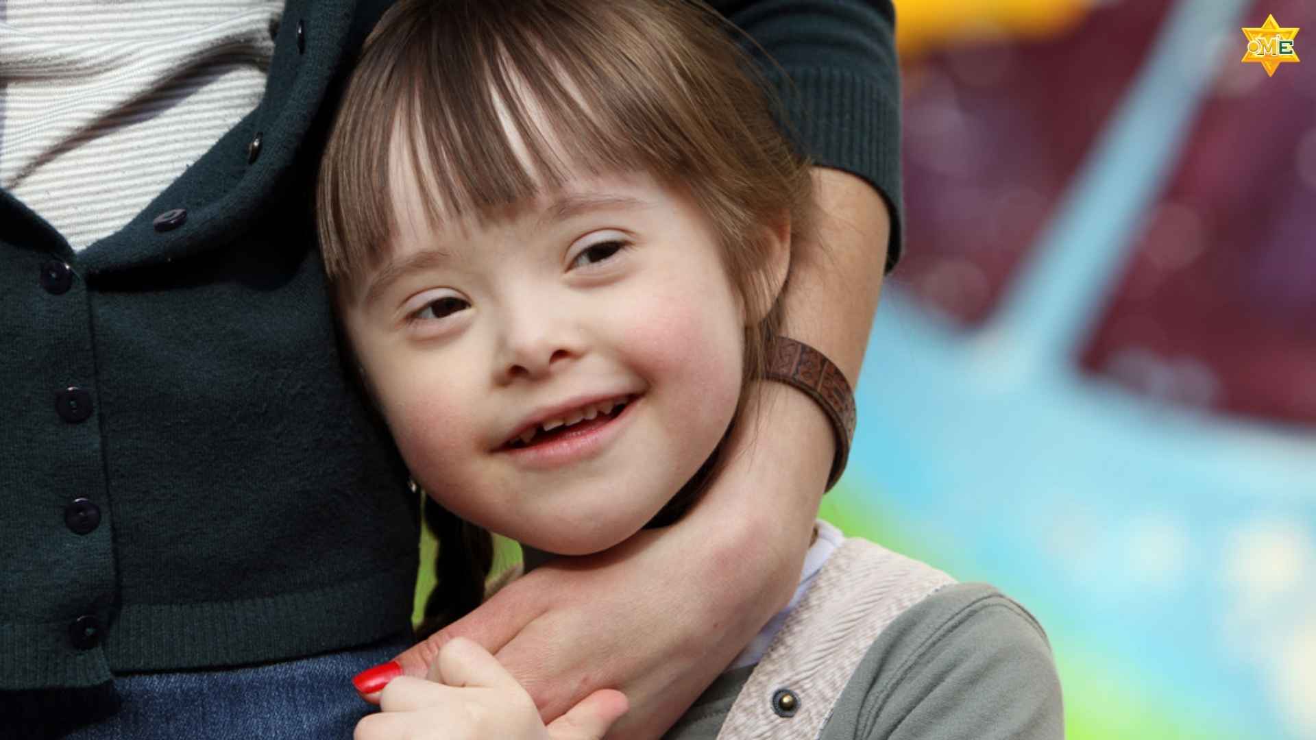 Hội chứng Down là bệnh gì