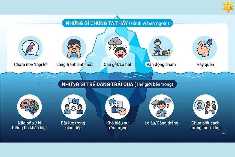 8 Biểu hiện chậm phát triển trí tuệ