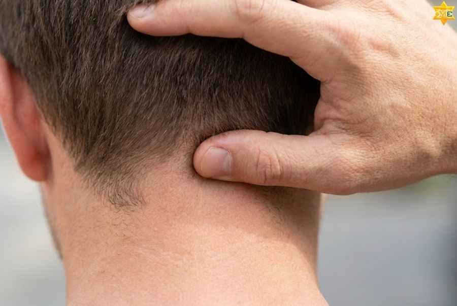 Công dụng của huyệt Á Môn trong điều trị bệnh