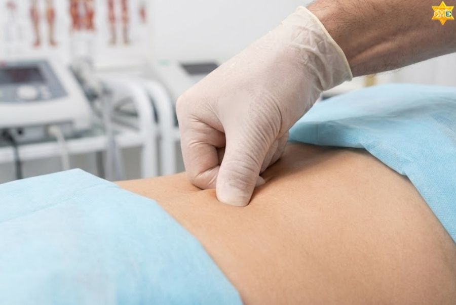 công dụng của huyệt Can Du