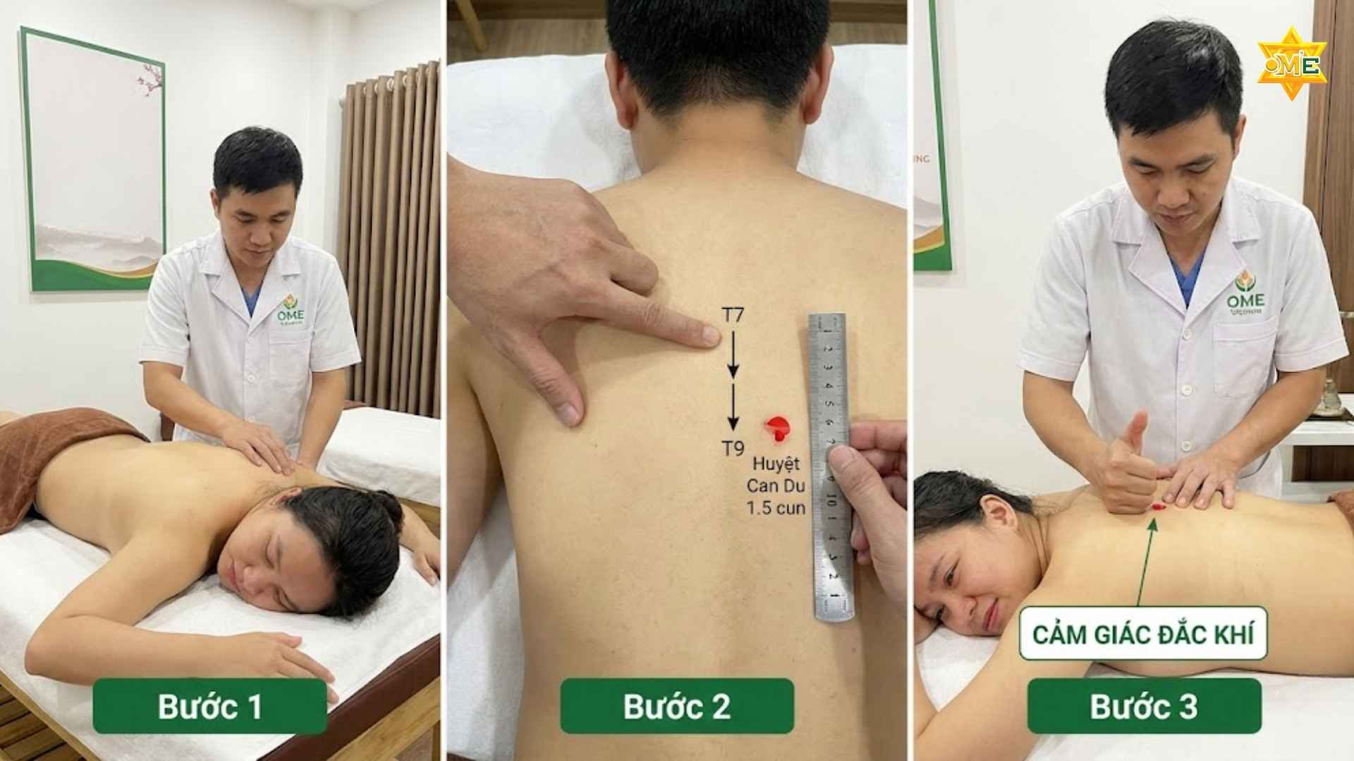 Cách xác định huyệt Can Du chuẩn xác 