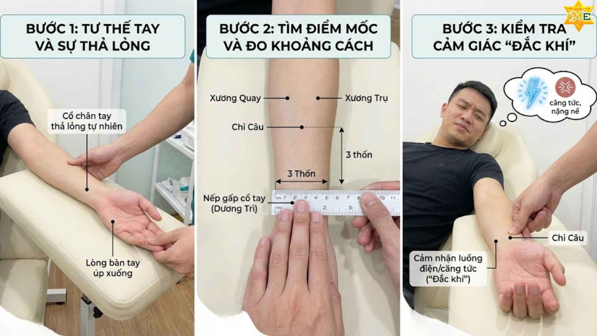 Cách xác định huyệt Chi Câu chuẩn xác