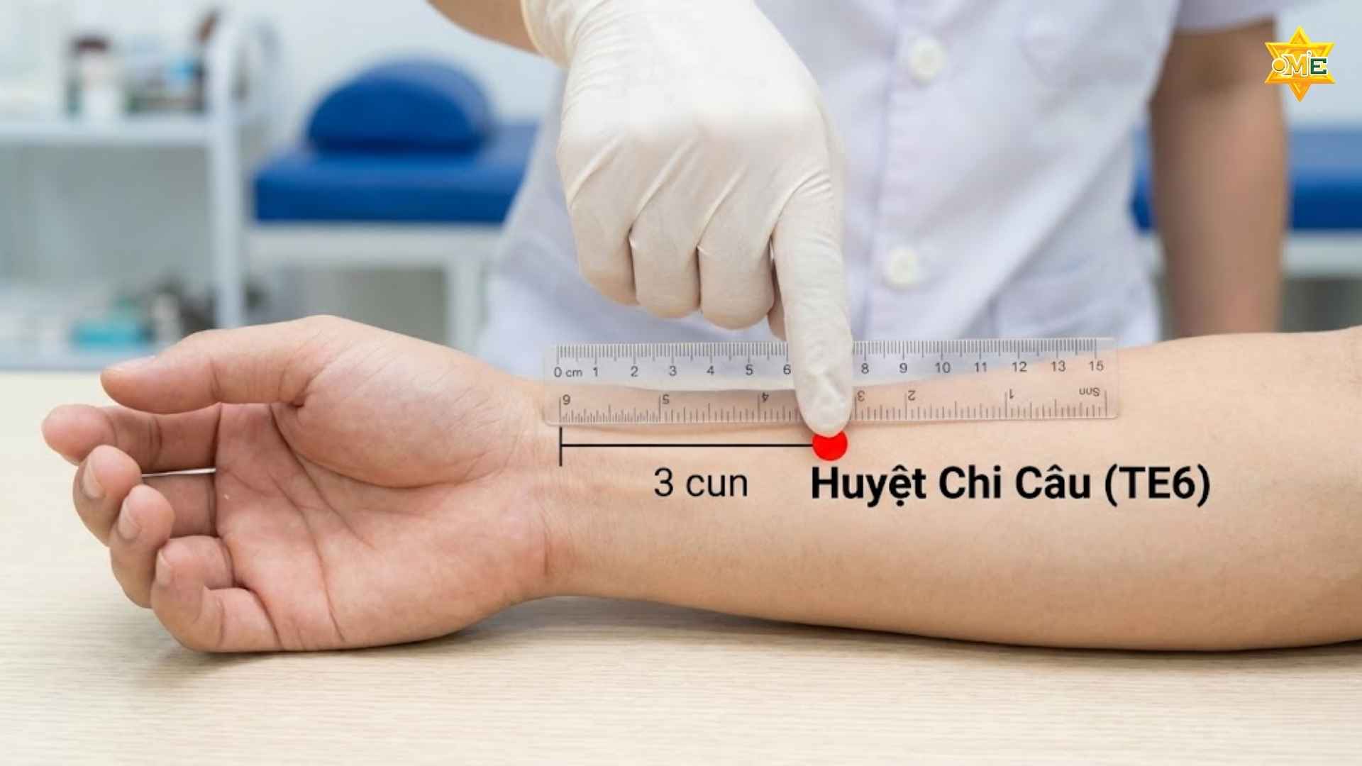 Cách xác định huyệt Chi Câu chuẩn xác