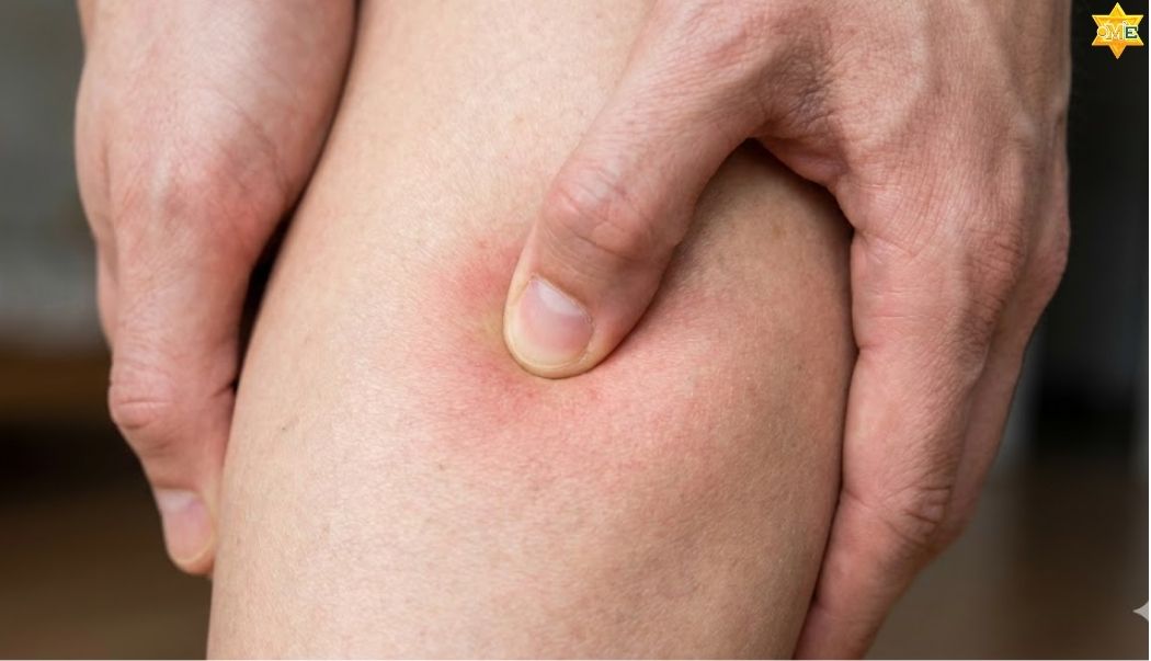 Những Lưu Ý Quan Trọng Khi Bấm Huyệt