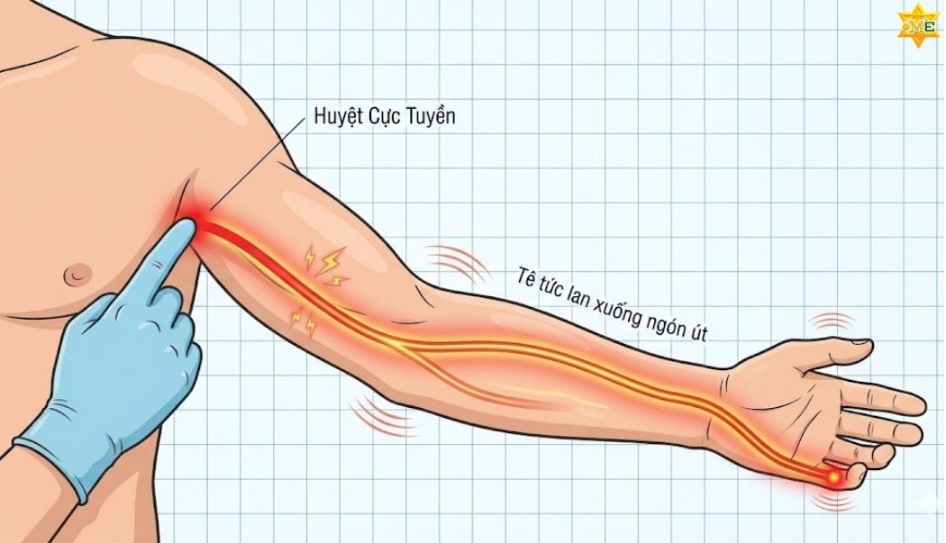Huyệt Cực Tuyền