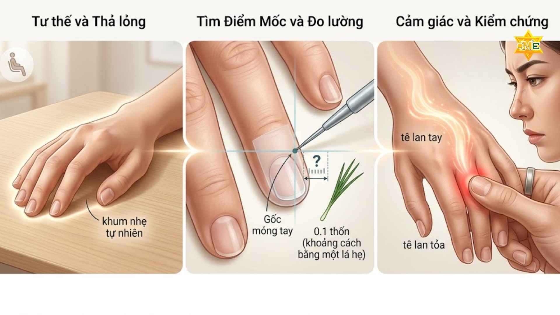 Cách xác định huyệt Quan Xung