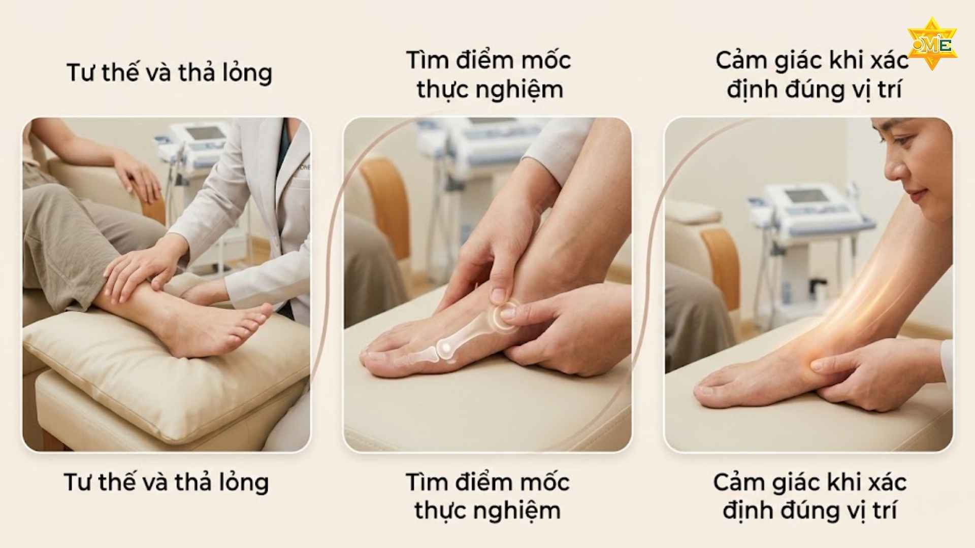 Cách xác định huyệt Công Tôn chuẩn xác giúp trị đau