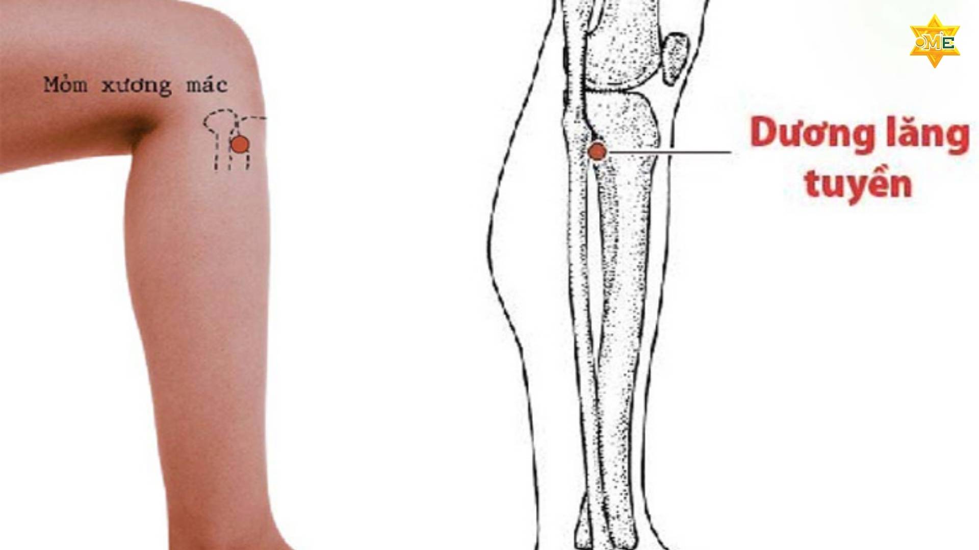 cách xác định huyệt Dương Lăng Tuyền 