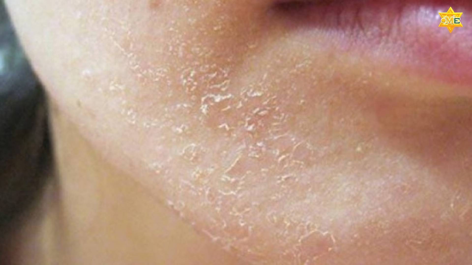 Tẩy tế bào chết định kỳ