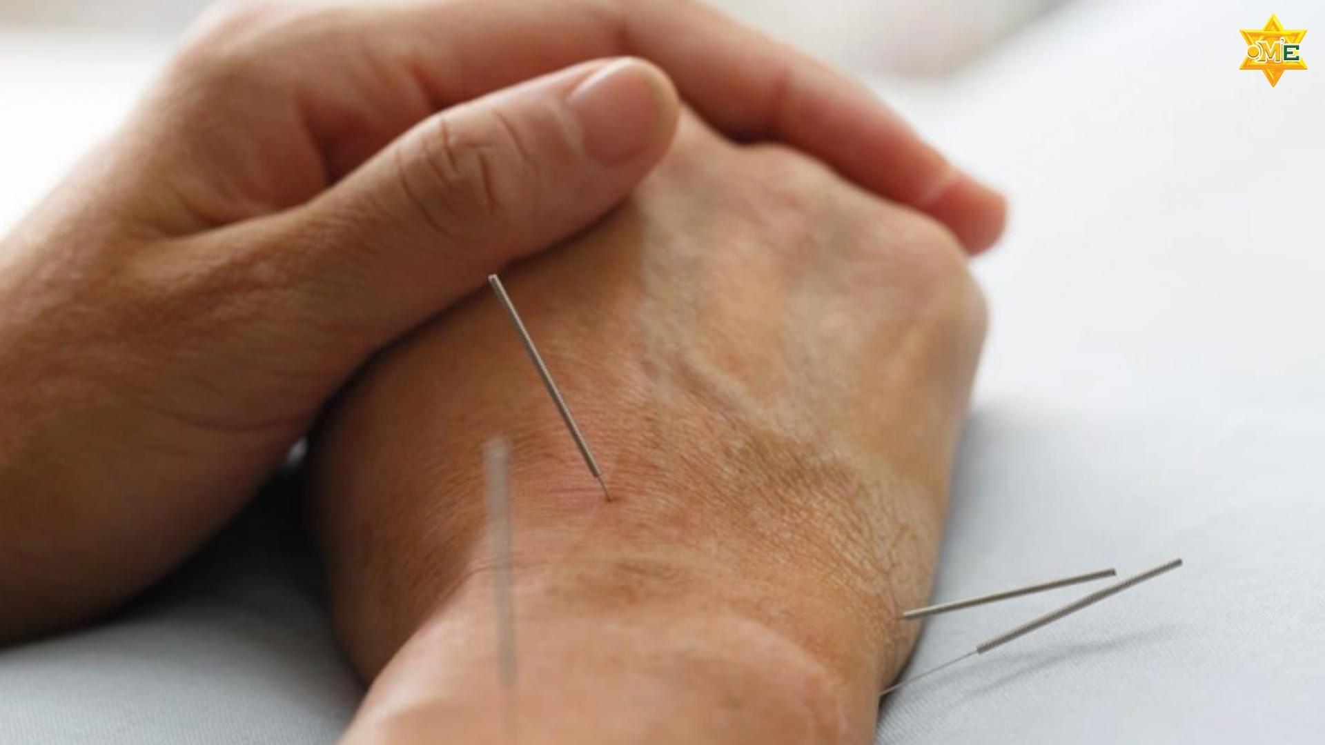 Cách xác định huyệt Dương Trì chuẩn