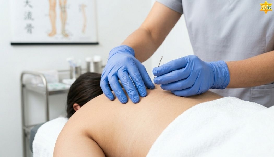 Kỹ thuật châm cứu huyệt thiên tông 