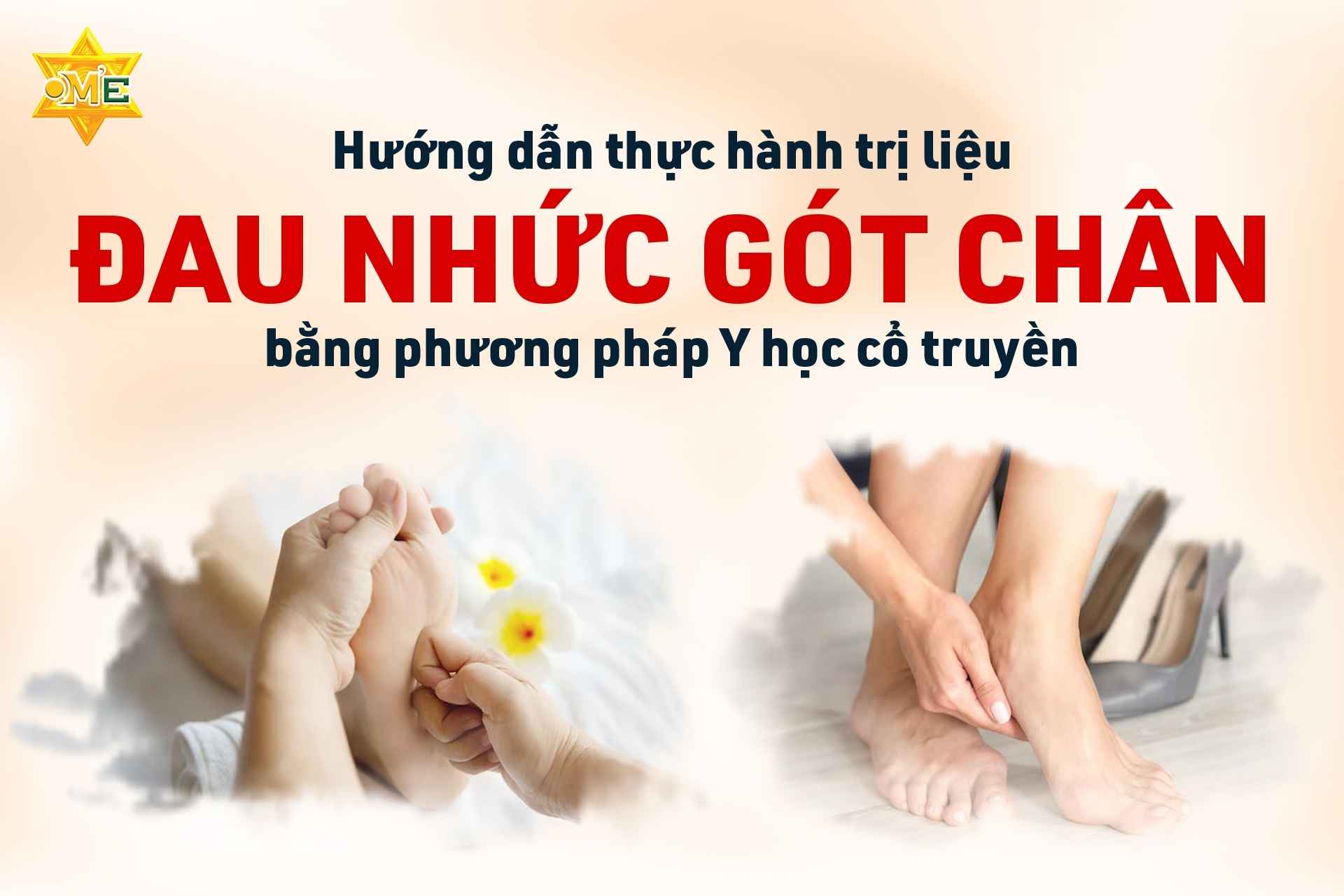Hướng dẫn thực hành trị liệu đau nhức gót chân bằng phương pháp Y học cổ truyền