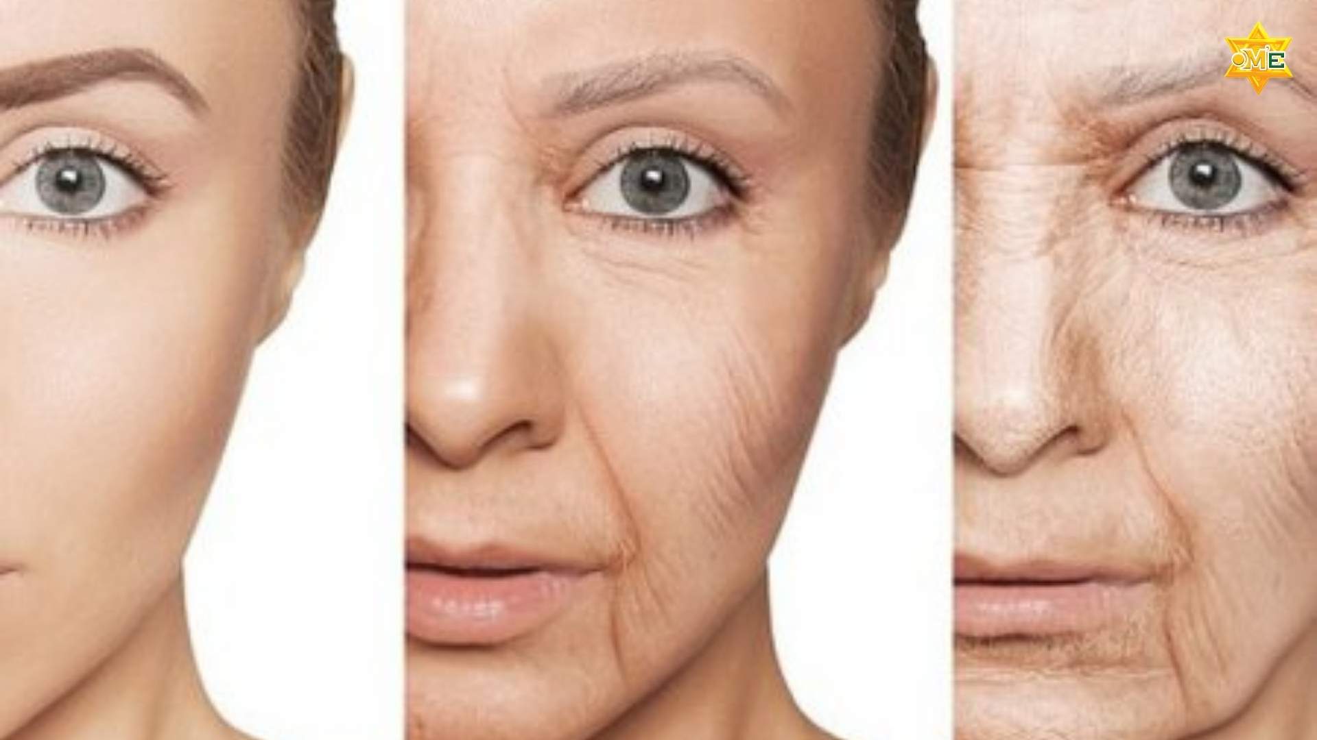 dấu hiệu lão hóa da sớm bạn không nên ngó lơ