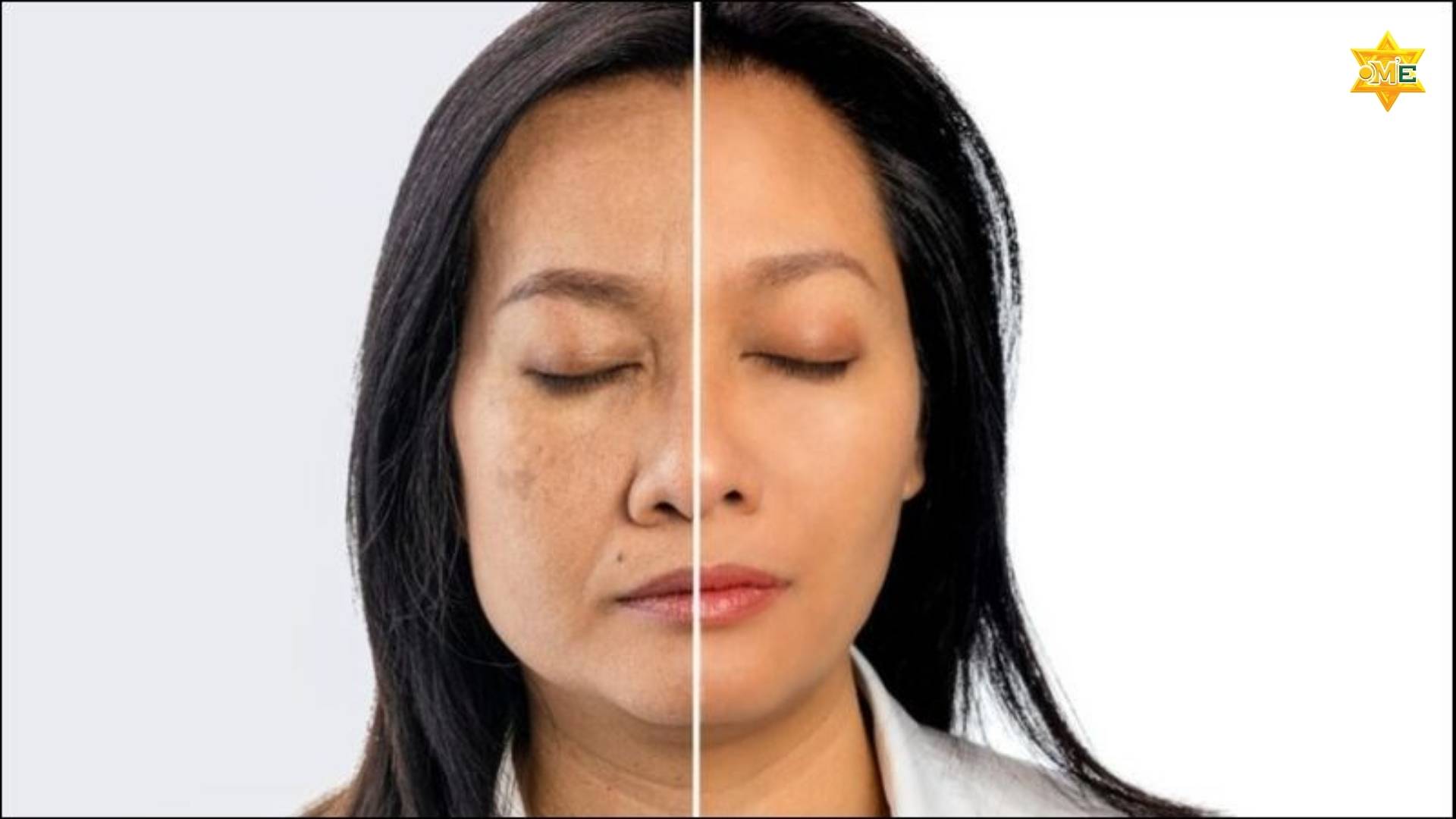 7 dấu hiệu lão hóa da sớm và bí quyết giúp trẻ hóa làn da