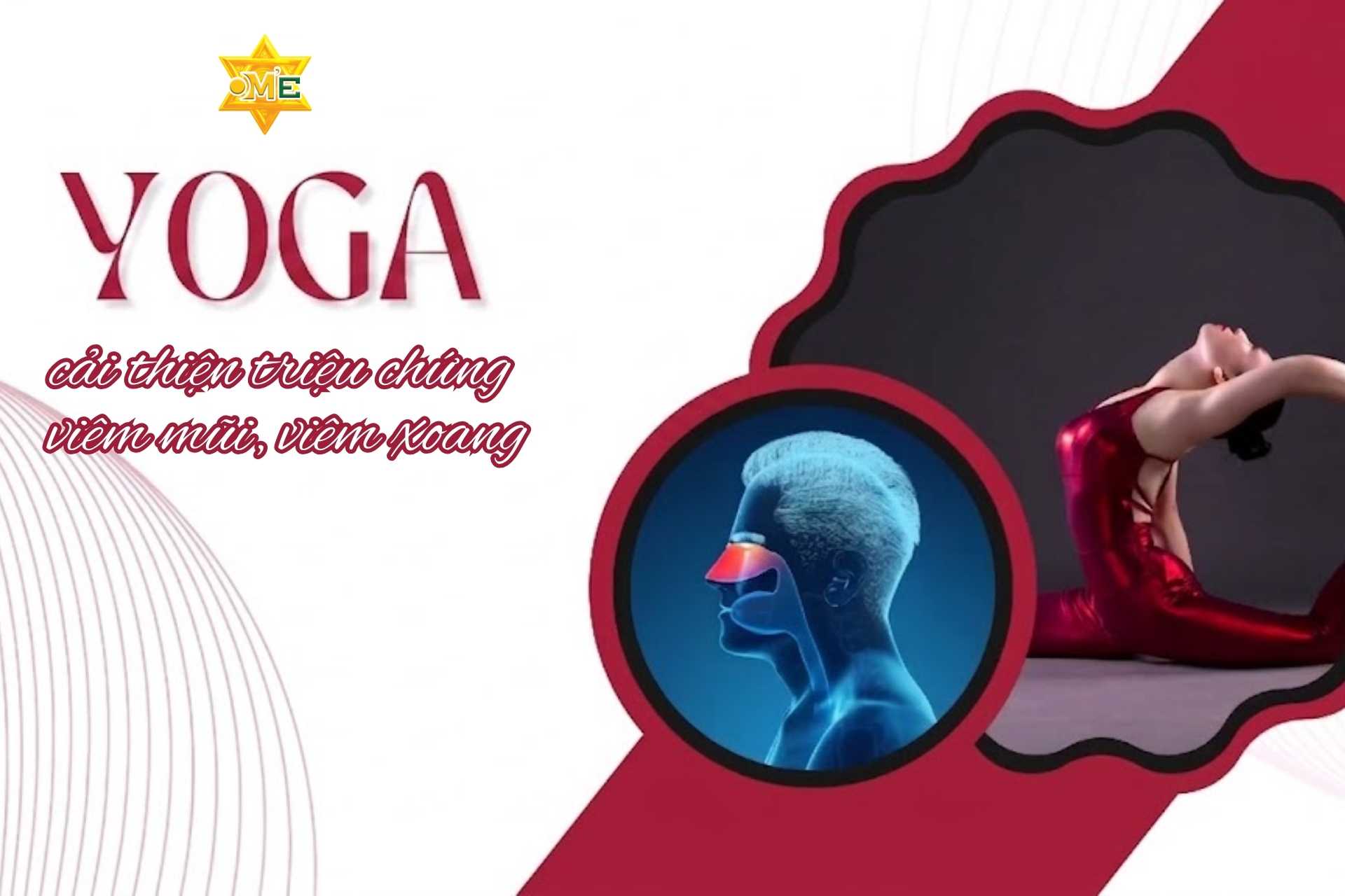 Yoga cải thiện triệu chứng viêm mũi, viêm xoang