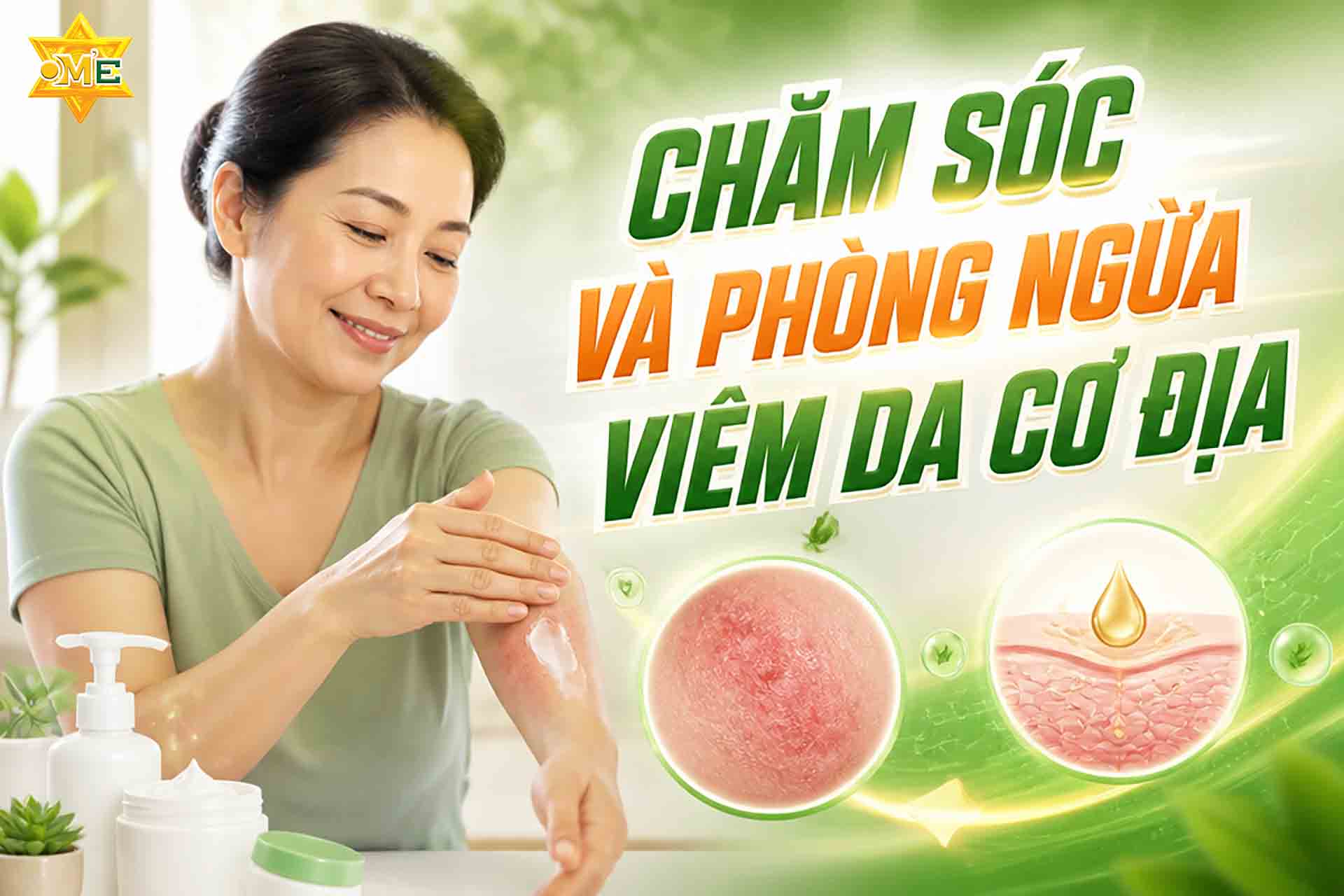 Chăm sóc và phòng ngừa viêm da cơ địa