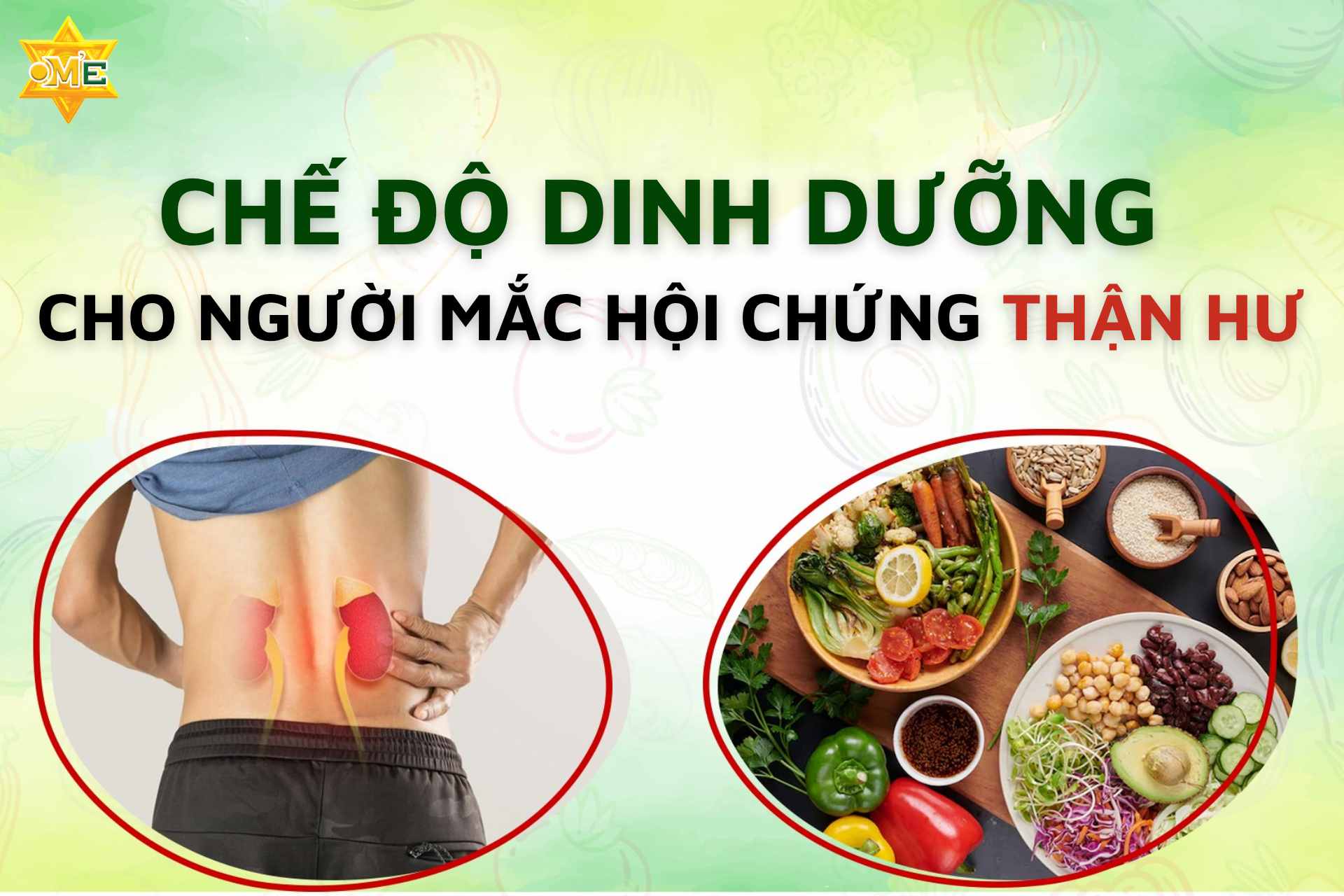 Chế độ dinh dưỡng cho người mắc hội chứng thận hư